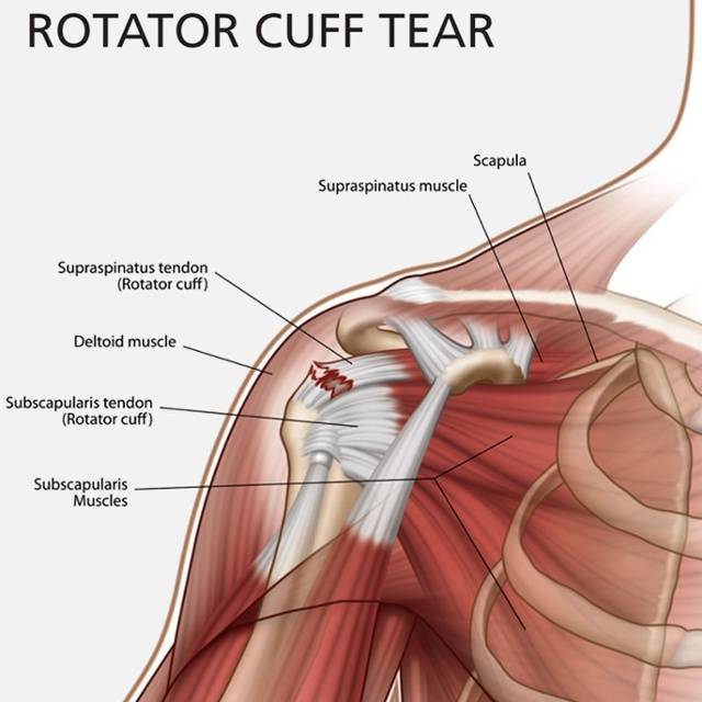 The Most Common Injuries In Major League Baseball